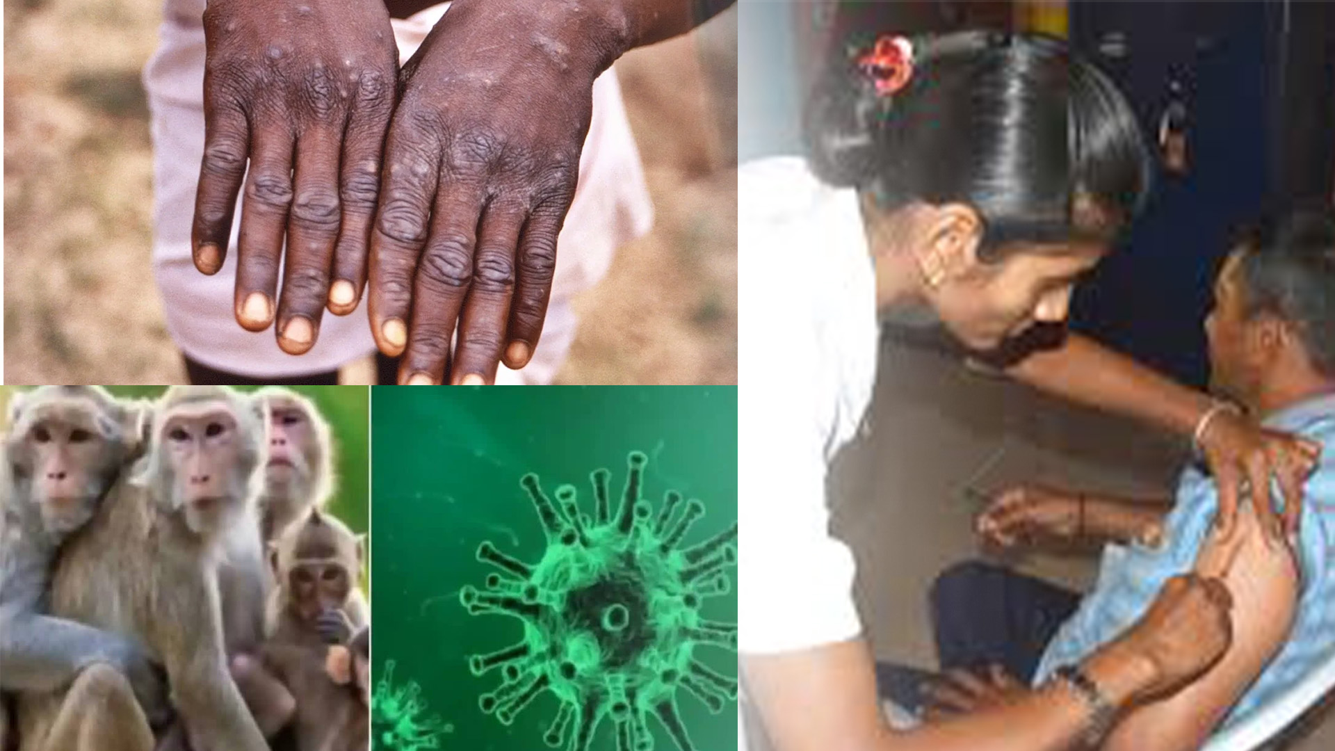 ಮಂಗನಕಾಯಿಲೆಗೆ ಮುಂದಿನ ವರ್ಷ ಲಸಿಕೆ?